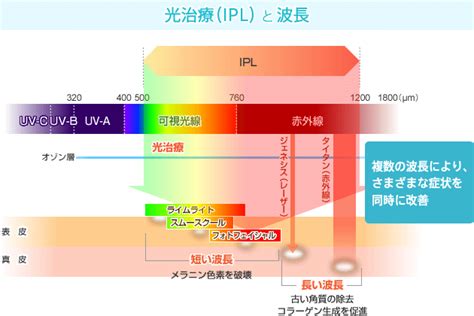 Iplパルス光の上泡 アクションプロの決定的なレーザーの上向き 990,001永久的な脈動の点滅と2つのモード 白 今年の新作から定番まで！