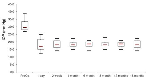 “Ab Interno” Surgery of the Schlemm’s Canal in Postuveitic Glaucoma ...
