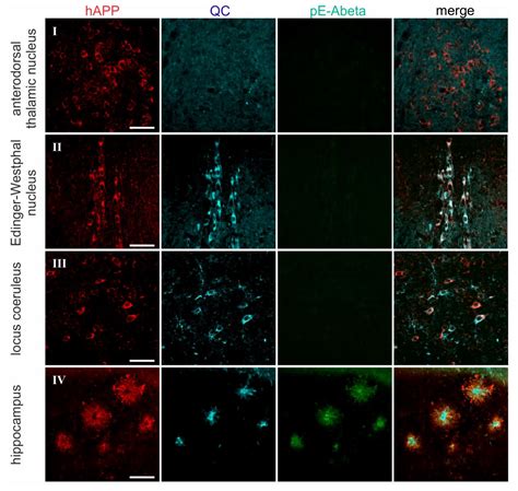 Immunohistochemical Evidence from APP-Transgenic Mice for Glutaminyl ...