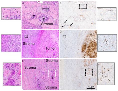 Cells | Special Issue : Ovary and Brain