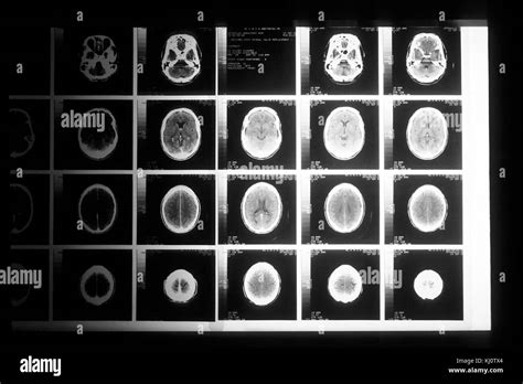 Image result for Rad Cat Scan