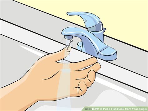 Image result for String Pull Method Fish Hook Removal