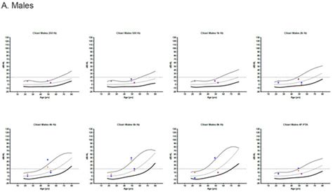 Audiovestibular Findings in a Cohort of Patients with Chiari ...