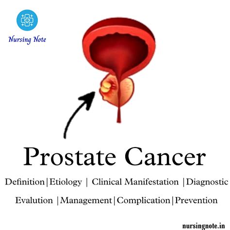 Prostate Cancer- 2nd Year GNM Medical Surgical Nursing II, Oncology ...