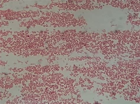 Proteus penneri- Introduction, Morphology, Pathogenicity, Lab Dia