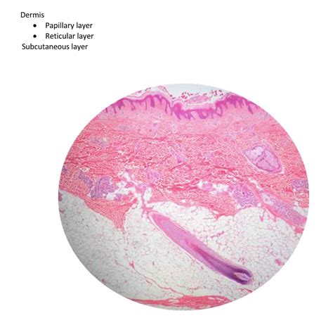 Reticular Layer Of Dermis