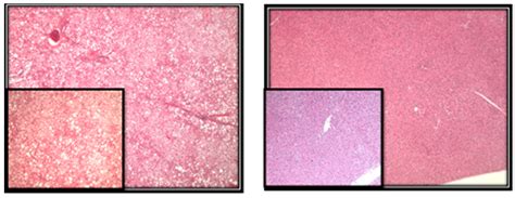 Effects of Obesity on Pro-Oxidative Conditions and DNA Damage in Liver ...