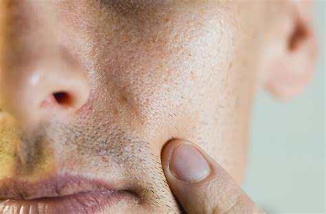 How to close men face open pores in skin - A complete guide – Blue Nectar