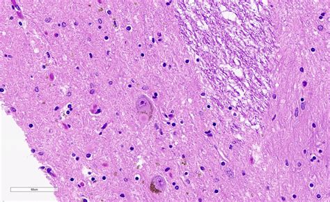 Multiple System Atrophy 的图像结果