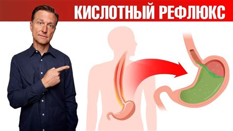 11 домашних средств против кислотного рефлюкса