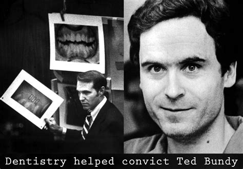 Ted Bundy Bite Mark Ted Bundy: A Killer... Ted Bundy: A Killer In