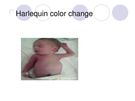 PPT - Comprehensive Newborn Assessment Guidelines PowerPoint ...