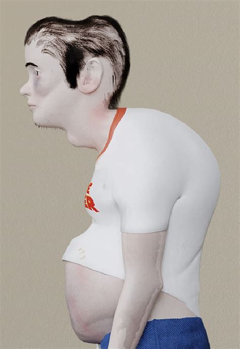 Do YOU have 'gamer head'? Twitch user finds indent on his cranium from ...