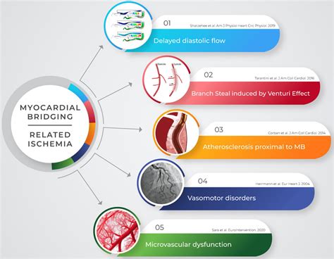 Frontiers | Comprehensive functional and anatomic assessment of myocardial bridging: Unlocking ...