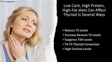 Ketogenic Diet. Here's What You Need To Know If You Have Hypothyroidism | Dr. Hagmeyer