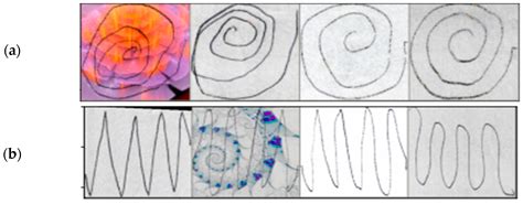Early Parkinson’s Disease Diagnosis through Hand-Drawn Spiral and Wave ...