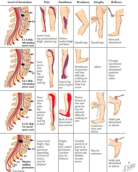 PhysioOsteoGram on Instagram: "LOWER & UPPER EXTREMITY NEUROLOGIC EXAMINATION ️ https://cms.aot ...