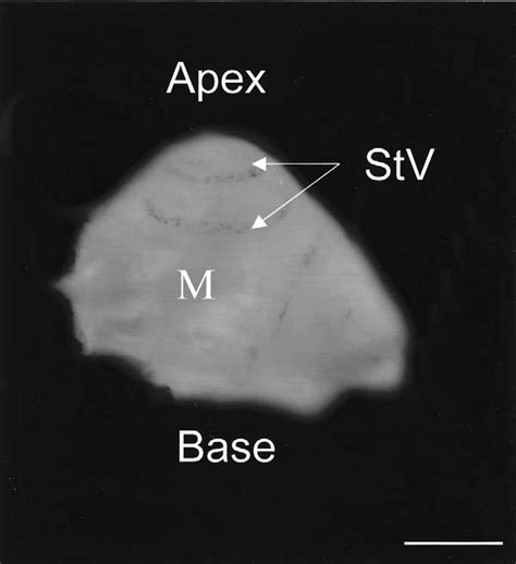Image result for Modiolus Cochlea