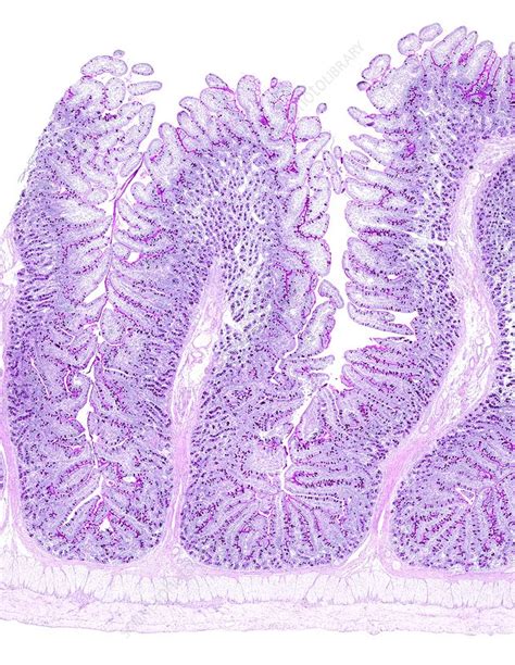 Image result for Jejunum Microscope