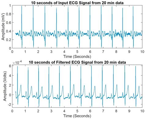 Complexity Analysis in the PR, QT, RR and ST Segments of ECG for Early ...