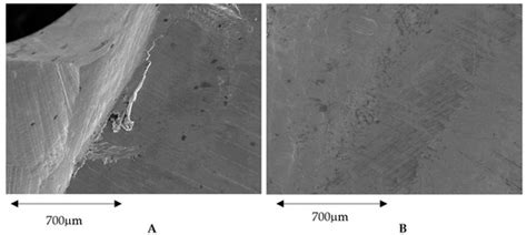 Influence of the CAD-CAM Systems on the Marginal Accuracy and ...