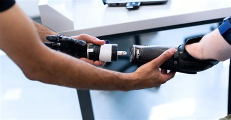 AI prosthetics- a better future for differently abled