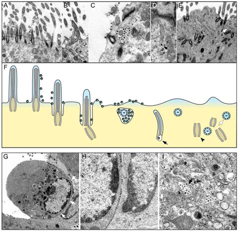 SARS-CoV-2 Infection Dysregulates Cilia and Basal Cell Homeostasis in ...