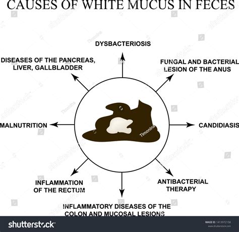 White Mucus In Stool