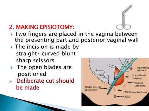 EPISIOTOMY AND ITS REPAIR.pptx
