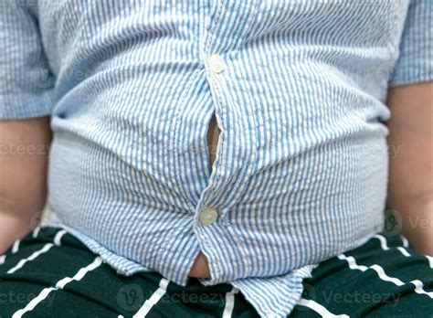 Tight shirt of obese fat boy overweight. 24604856 Stock Photo at Vecteezy