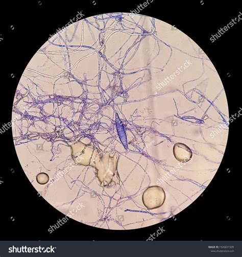 Ringworm Under Microscope