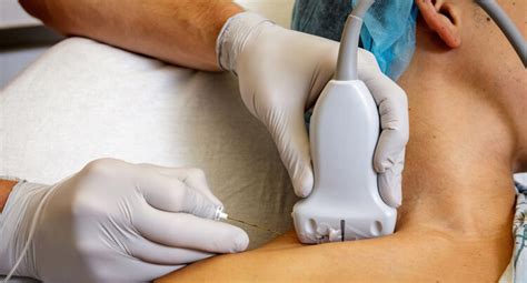 Nerve Block Injection 的图像结果