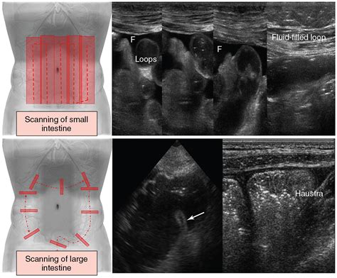 Various targets in the abdomen (hepatobiliary system, spleen, pancreas ...