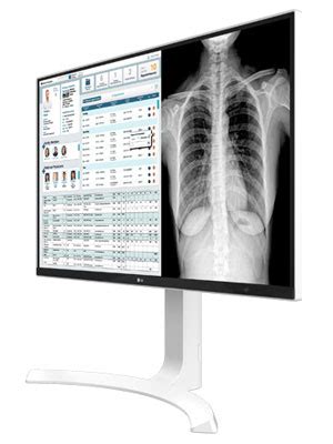 Clinical Review Monitors, Clinical Review Displays, Modality Monitor ...