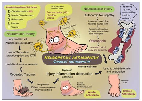 Neuropathic arthropathy: Charcot arthropathy - Creative Med Doses
