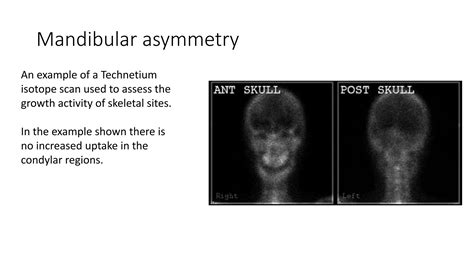 Embryonic Facial Development 的图像结果