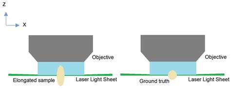 Distortion Correction and Denoising of Light Sheet Fluorescence Images