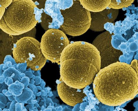 'Nose-y' Bacteria Could Yield A New Way To Fight Infection : Shots ...