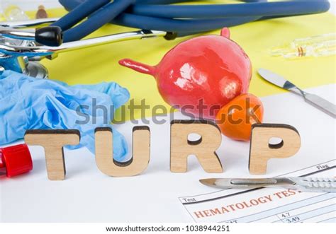 Image result for Turp Procedure Explained