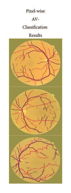 Image result for Channel AV Classification
