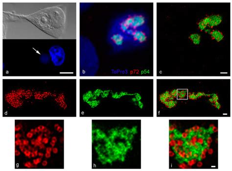 Unpicking the Secrets of African Swine Fever Viral Replication Sites
