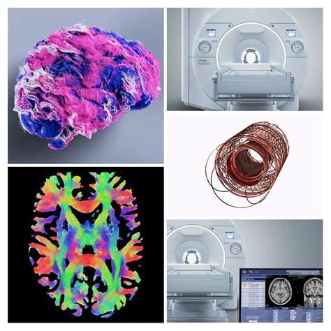 GE HealthCare Receives FDA Clearance for Head-Only SIGNA MAGNUS 3.0T MRI System GE HealthCare ...
