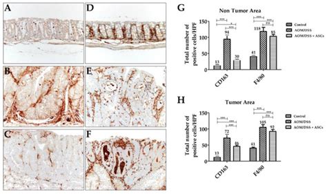M1 Macrophages Promote TRAIL Expression in Adipose Tissue-Derived Stem ...