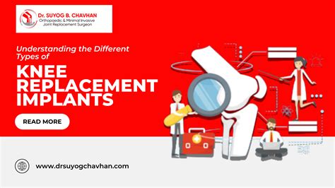 Understanding the Different Types of Knee Replacement Implants