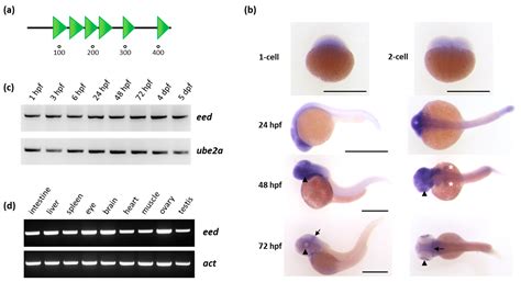 Loss of Polycomb Repressive Complex 2 Function Alters Digestive Organ ...