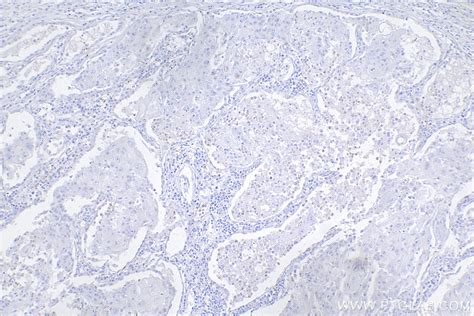 FOXP3 antibody (68803-2-Ig) | Proteintech