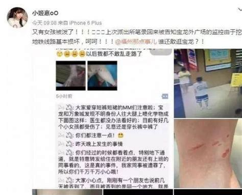 福州：短裙女孩被泼不明液体 一个月发现四起 - 焦点图片 - 东南网三明频道