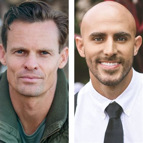 Hoher Haaransatz: Was ist die Ursache und wie behandelt man ihn ...