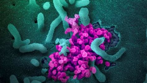 Researchers develop antibodies for neutralising SARS-Cov-2, the virus ...