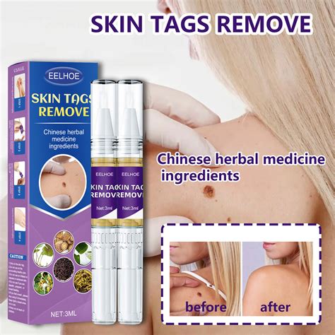 Buy Skin Wart Remover Salicylic Acid 17% Removedor de Verrugas Online ...